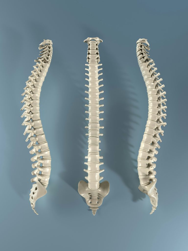 la Posture