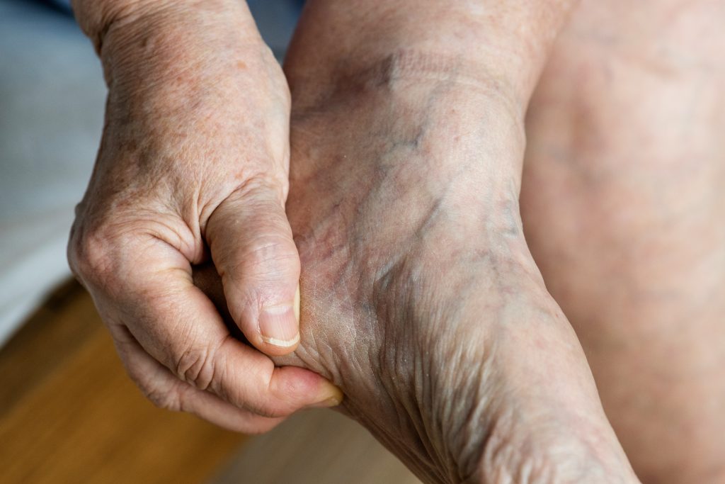 tendons d'achille